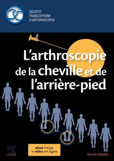 L'arthroscopie de la cheville et de l'arrière-pied