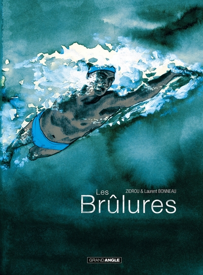 Les brûlures